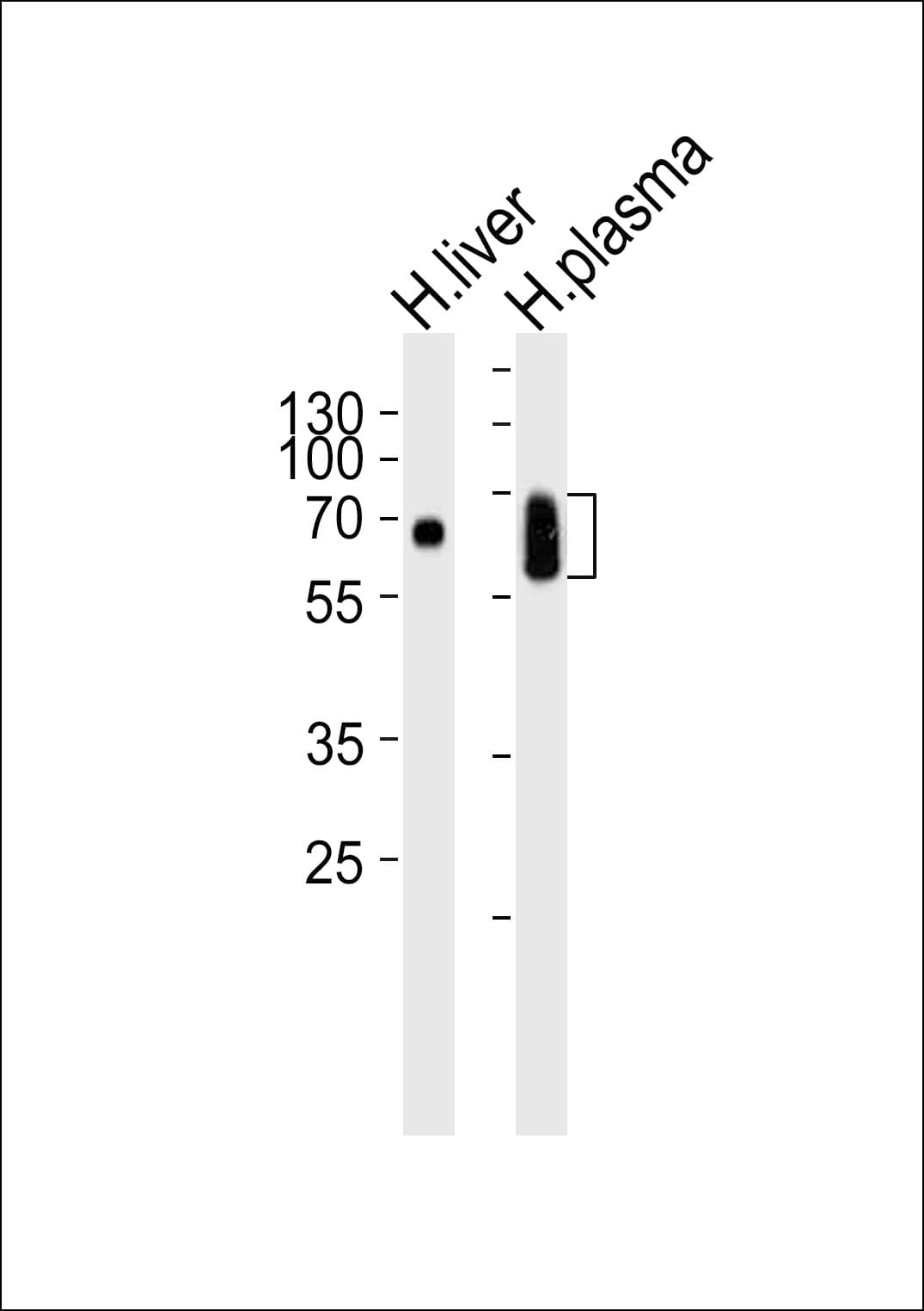 LP-PLA2 / PLA2G7 Antibody (aa200-228)