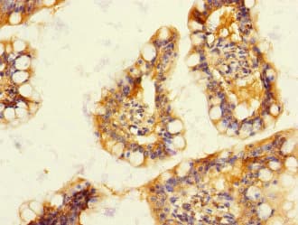 Polyclonal Rabbit anti-Human DUOX2 Antibody (IHC)