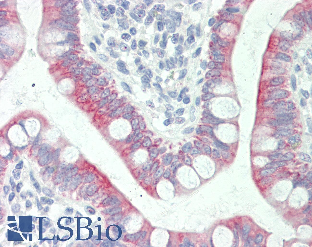 SLC41A1 Antibody (aa36-85)