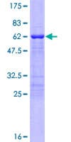Human TBX20 Protein (Recombinant GST)