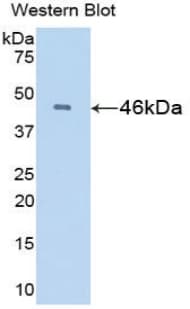 IFN Beta / Interferon Beta Antibody (aa22-186)