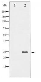 TIMP4 Antibody