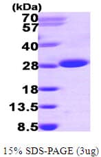 Human ITPA Protein (Recombinant His)