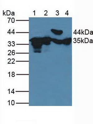 FN3K / Fructosamine-3-Kinase Antibody (aa1-309)