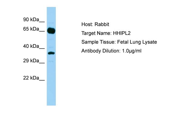 HHIPL2 Antibody (aa606-655)