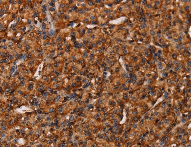 Endostatin Antibody