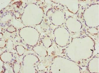 Polyclonal Rabbit anti-Human NFIL3 Antibody (IHC)