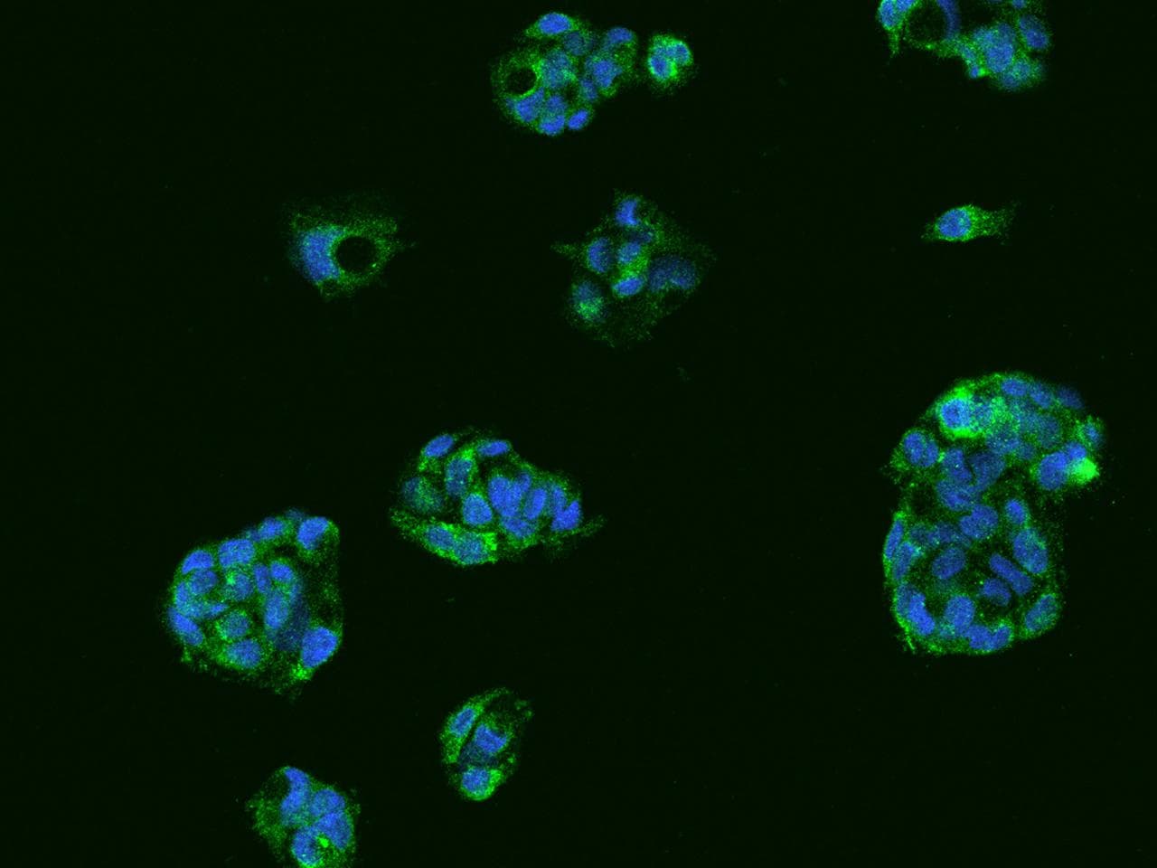 TTR / Transthyretin Antibody
