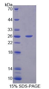 Human PTPN21 / PTPD1 Protein (Recombinant)