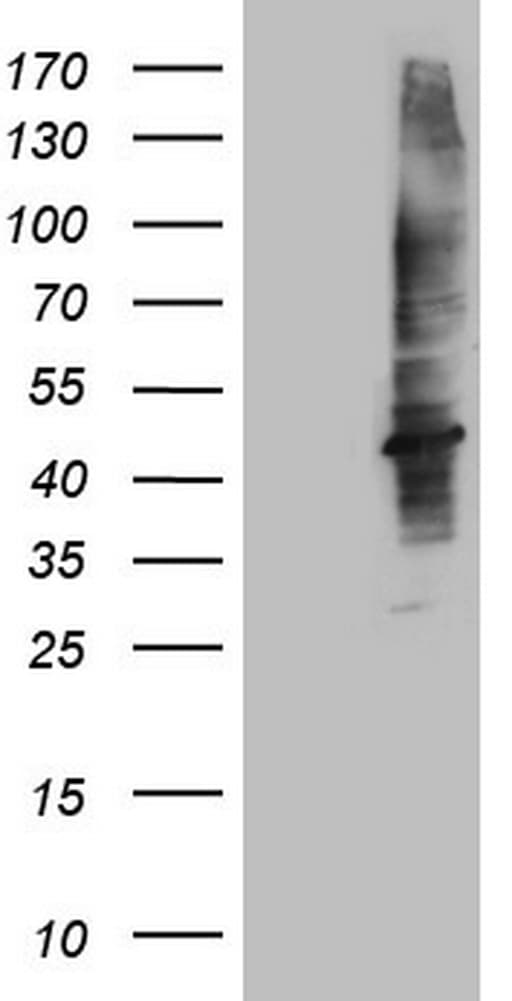MTOR Antibody (aa1766-2144, clone OTI1G4)
