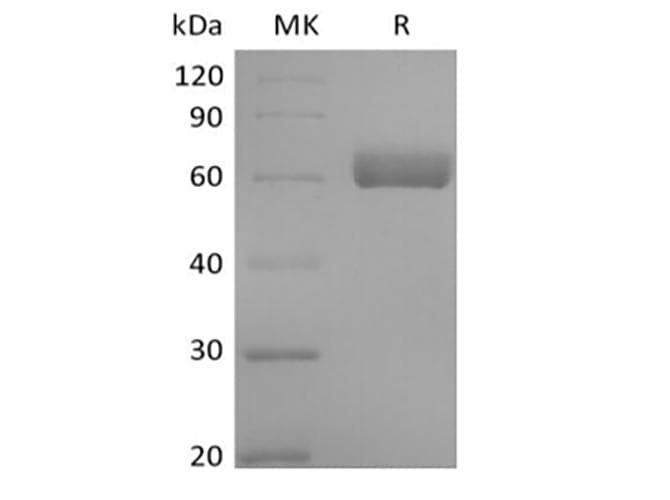 Human BTNL9 Protein (Recombinant Fc, C-terminus)