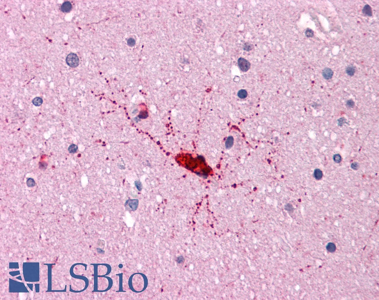 IHC-plus™ BCAS1 / NABC1 Antibody