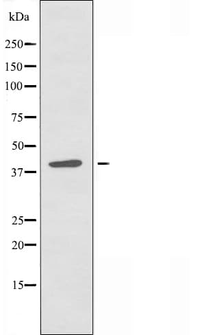Polyclonal Rabbit anti-Human ZFP36L2 Antibody (IF, WB)