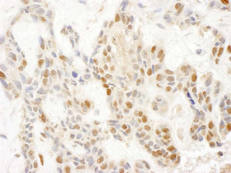 Polyclonal Rabbit anti-Human POP1 Antibody (aa925-975, IHC, IF)