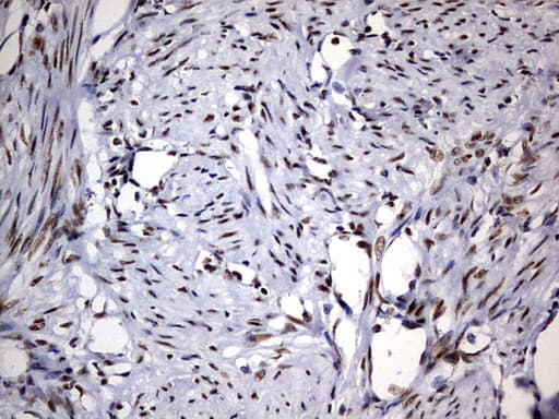 DDX56 Antibody (aa323-547, clone OTI11H7, Carrier-free)