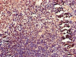 Polyclonal Rabbit anti-Human HELLS Antibody (IHC)