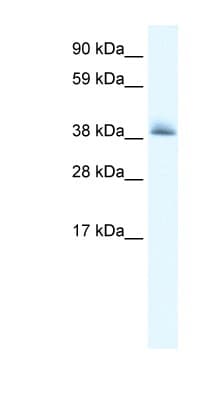 Polyclonal Rabbit anti-Human KCTD13 Antibody (aa26-75, IHC, WB)