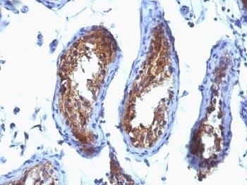 MVP / VAULT1 Antibody (clone SPM280)