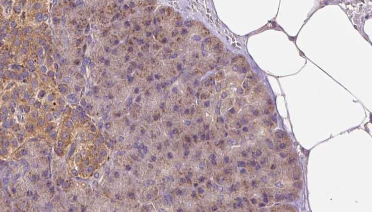 LAPTM4B Antibody