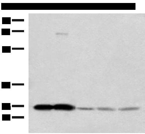 Polyclonal Rabbit anti-Human OVOL2 Antibody (IHC, WB)