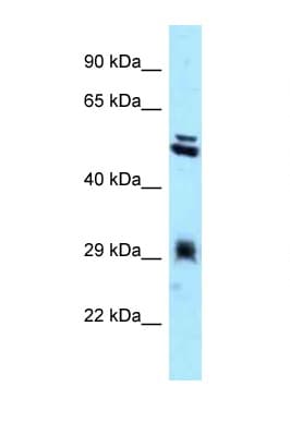 TXNDC1 / TMX1 Antibody (C-Terminus)