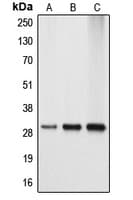 Polyclonal Rabbit anti-Human APOA1BP Antibody (Internal, IF, WB)