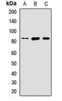 SLC39A6 / LIV-1 Antibody