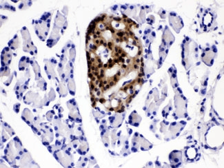 Polyclonal Rabbit anti-Human ACLY / ATP Citrate Lyase Antibody (IHC, WB)