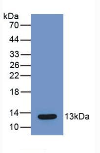 CCL2 / MCP1 Antibody