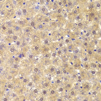 PHAP1 / ANP32A Antibody