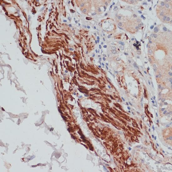DES / Desmin Antibody