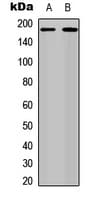 ERBB4 / HER4 Antibody (phospho-Y1284)