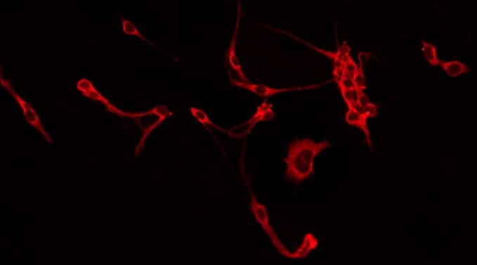 ITGB5 / Integrin Beta 5 Antibody