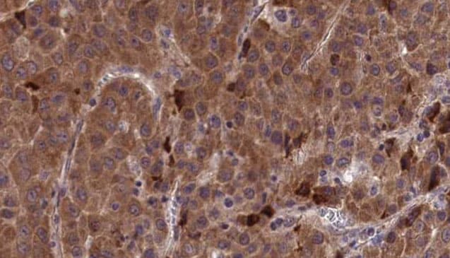 ZAP70 Antibody