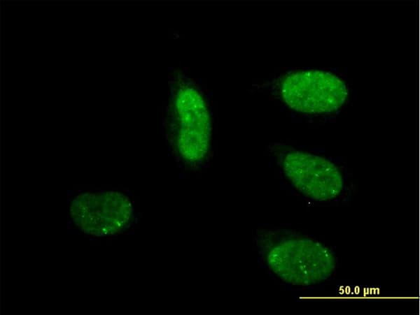 IHC-plus™ MED17 / TRAP80 Antibody (clone 4D4)