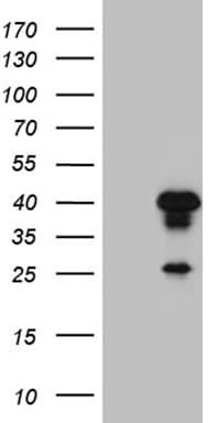 AEBP2 Antibody (clone OTI11F3)