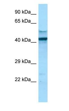 FCGR1A / CD64 Antibody (C-Terminus)