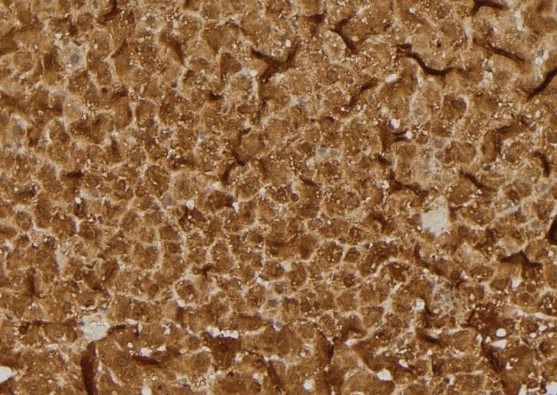 Polyclonal Rabbit anti-Human RHOB Antibody (IHC, IF, WB)