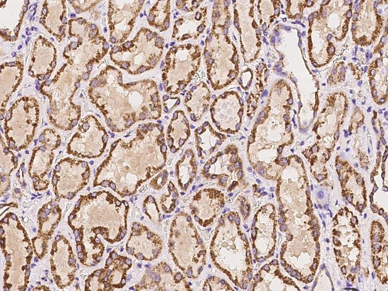 Polyclonal Rabbit anti-Human HMGCL Antibody (IHC, IF)