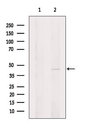 UCK2 Antibody