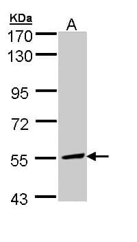 Polyclonal Rabbit anti-Human MLYCD / MCD Antibody (aa90-304, IHC, WB)