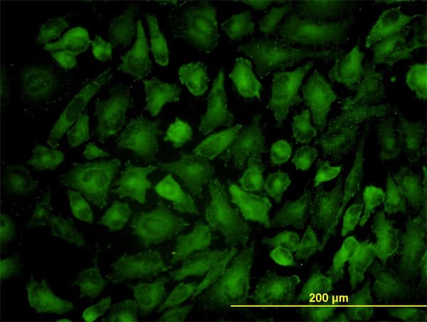 VCL / Vinculin Antibody (clone 2C6-1B5)