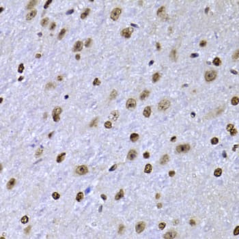 Polyclonal Rabbit anti-Human SOX5 Antibody (aa1-120, IHC, IF, WB)