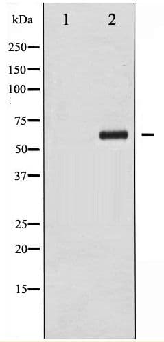 Polyclonal Rabbit anti-Human CHEK2 / CHK2 Antibody (phospho-Thr383, IF, WB)
