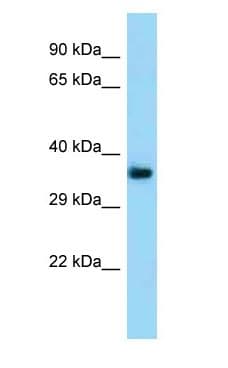 TMEM164 Antibody (aa76-125)