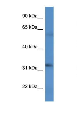 BCO2 / BCDO2 Antibody (aa391-440)