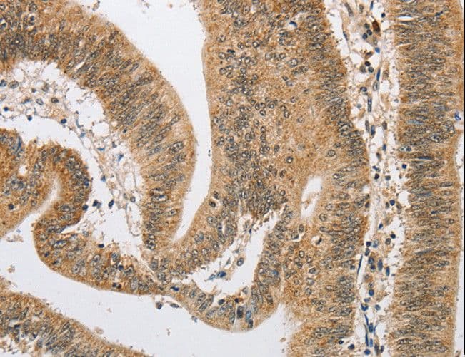 ARHGAP25 Antibody