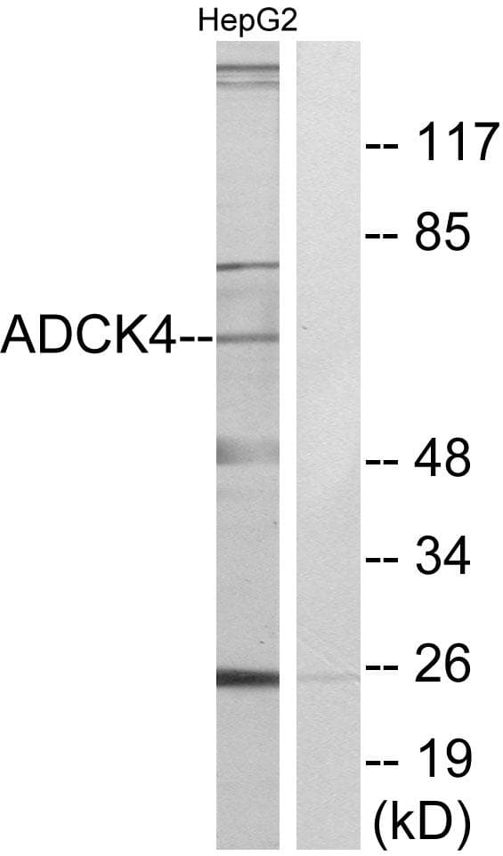 ADCK4 Antibody