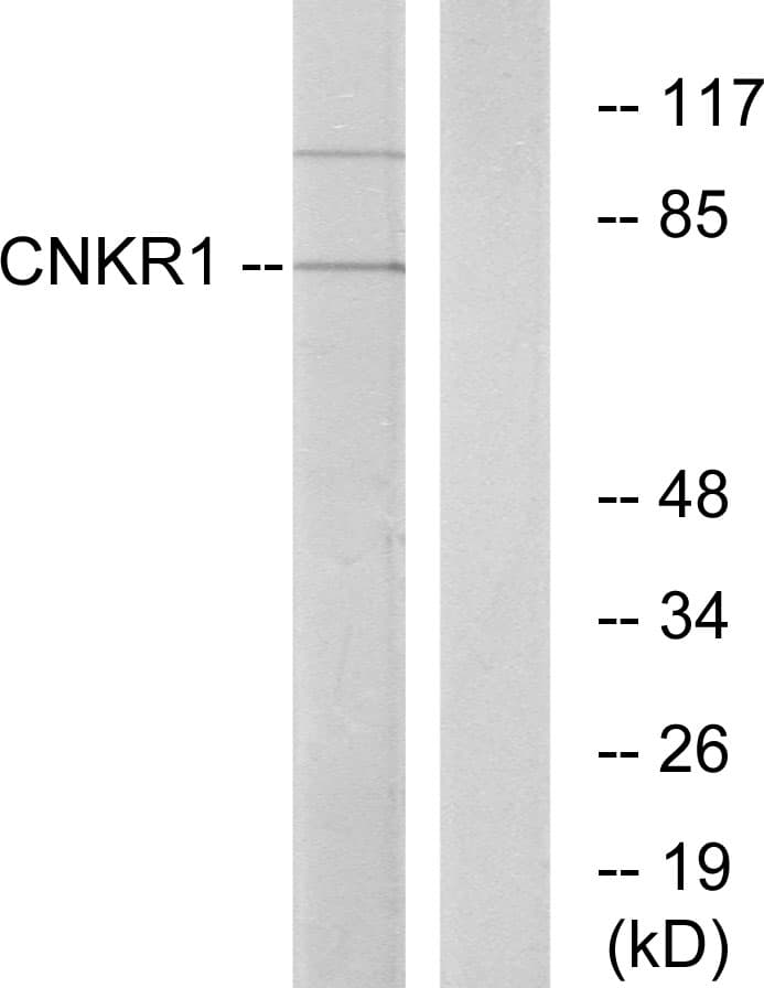 CNKSR1 Antibody (aa491-540)