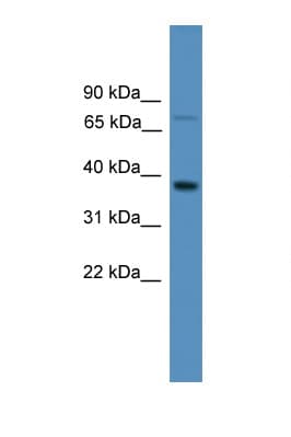 OR1S1 Antibody (aa251-300)